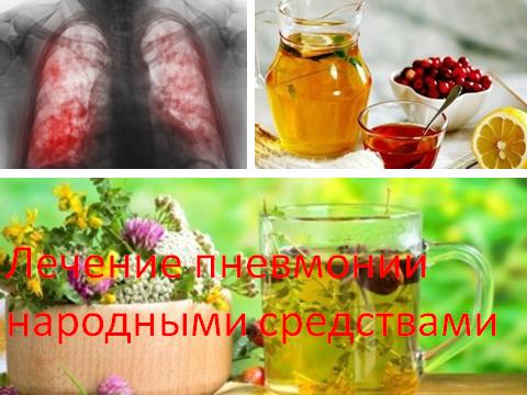 лечение воспаления легких (пневмонии)